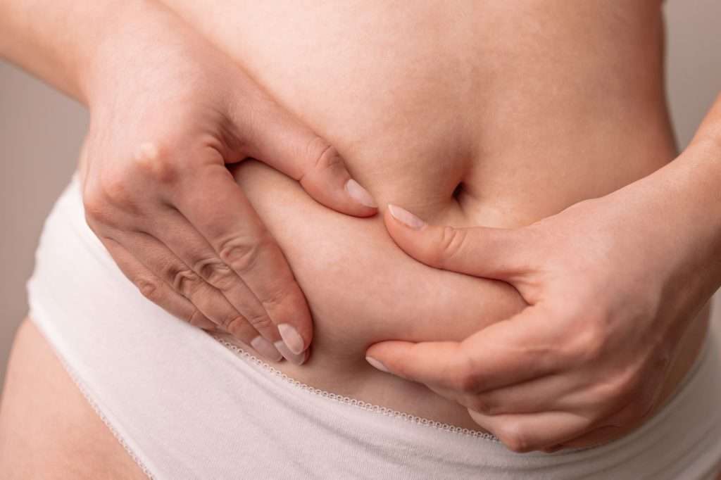 Fat female belly, woman holding skin to check cellulite.