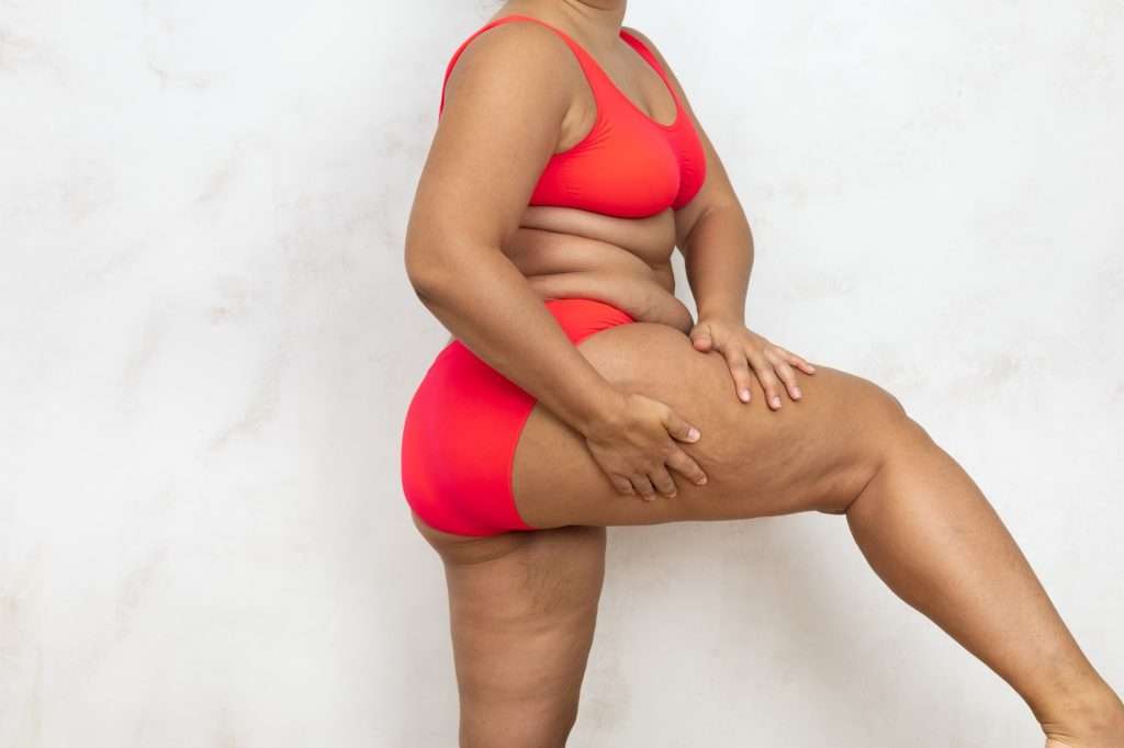Overweight woman standing sideways massage raised thigh by hands, free copy space, white background